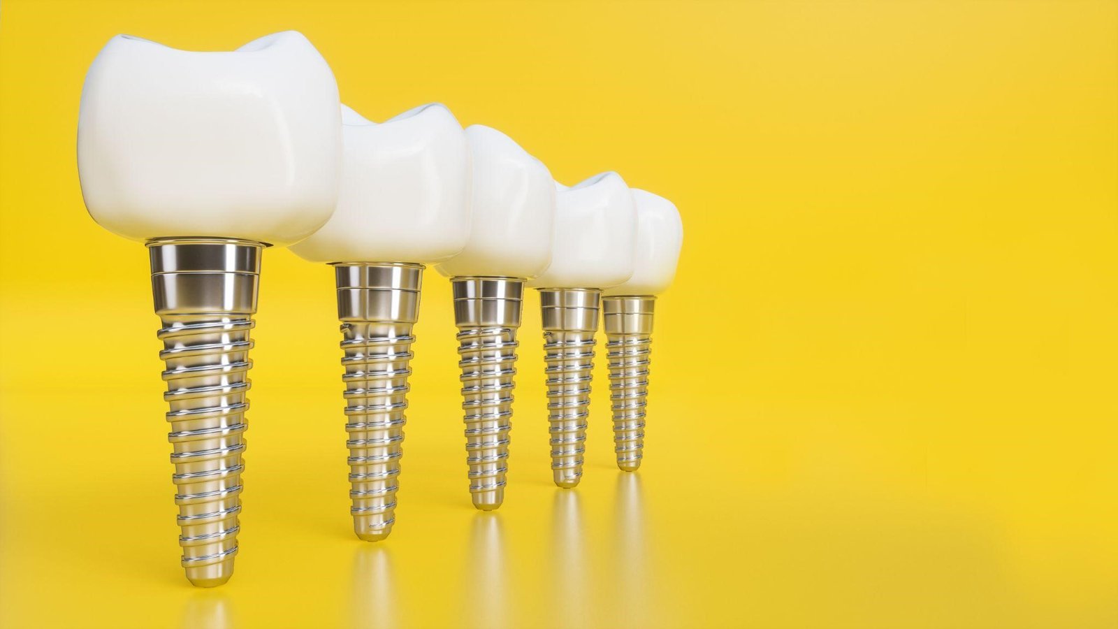 Dental implant problems